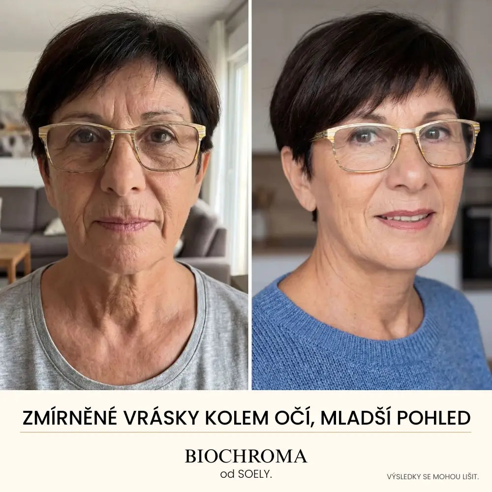 Biochroma Sérum od Soely