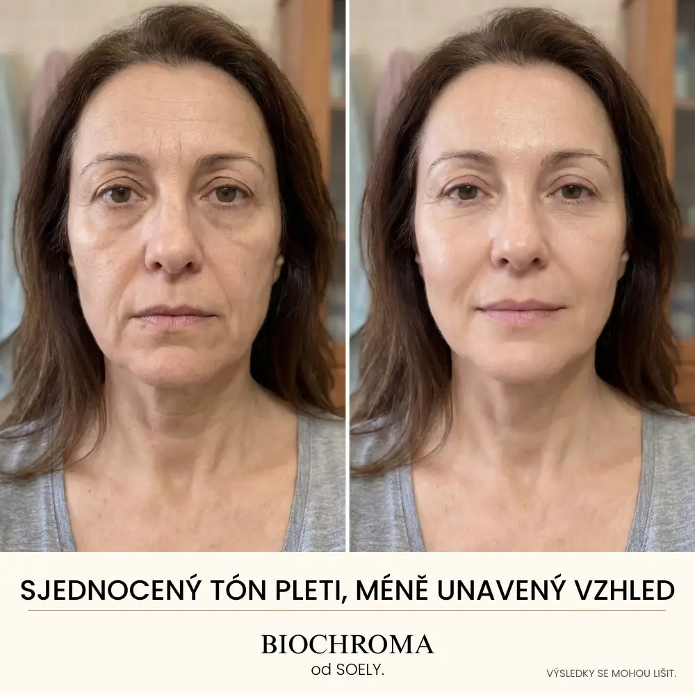 Biochroma Sérum od Soely