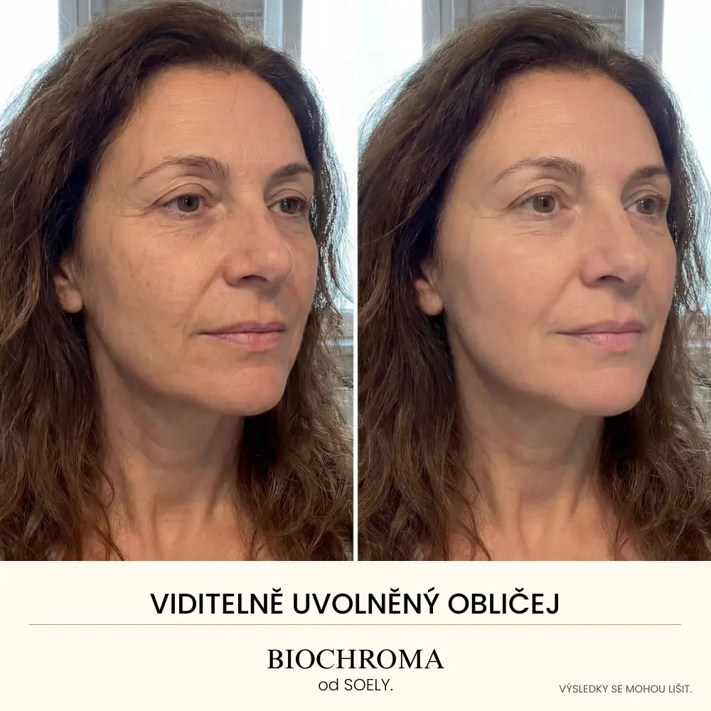 Biochroma Sérum od Soely