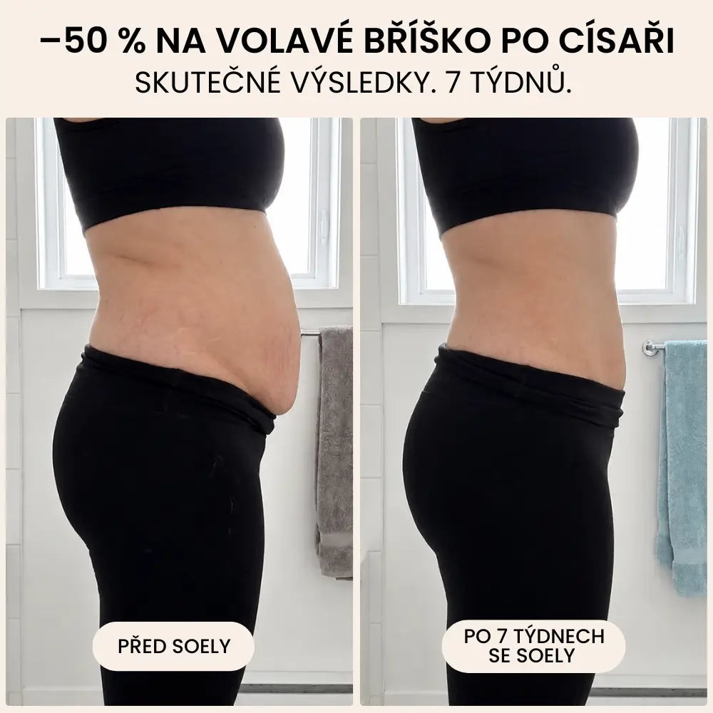 POPORODNÍ KALHOTKY — KOMPRESE 360°