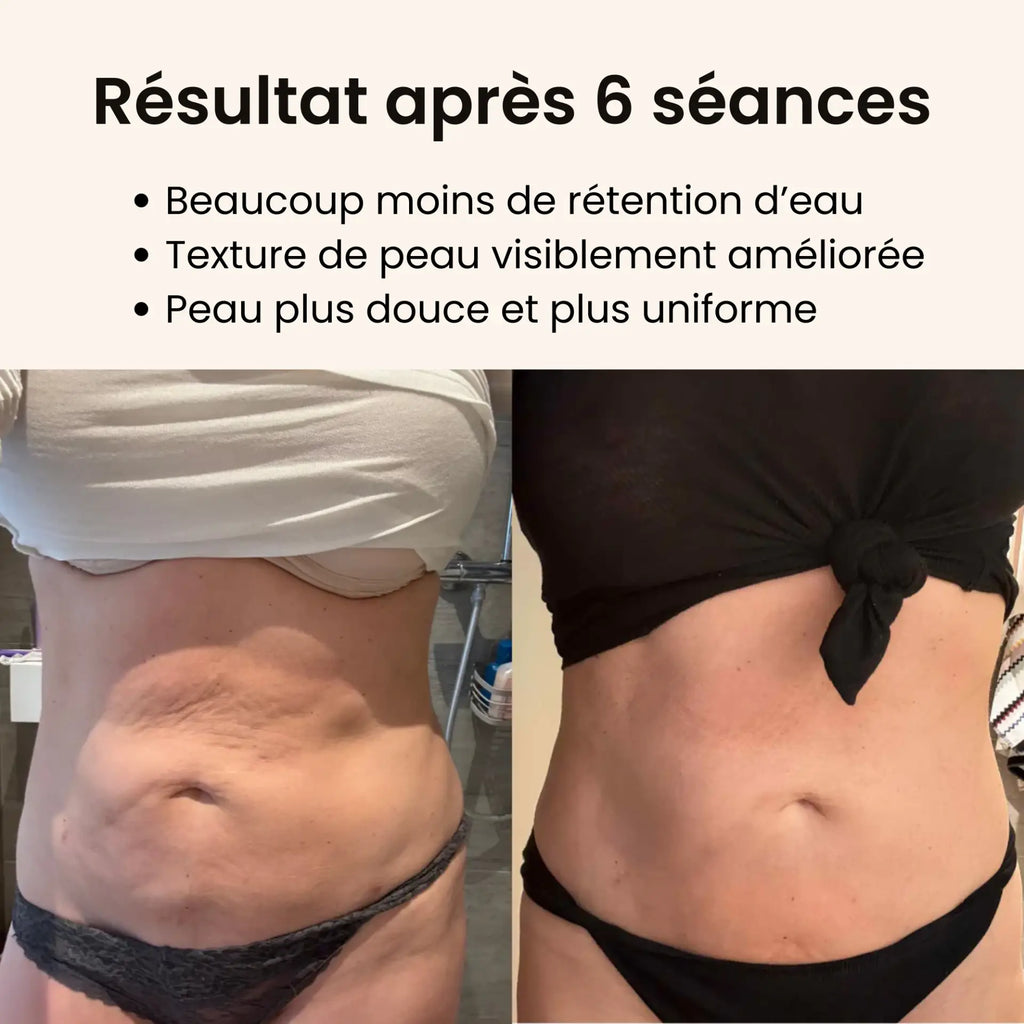 CelluFlow™ - Une peau plus lisse en 14 jours