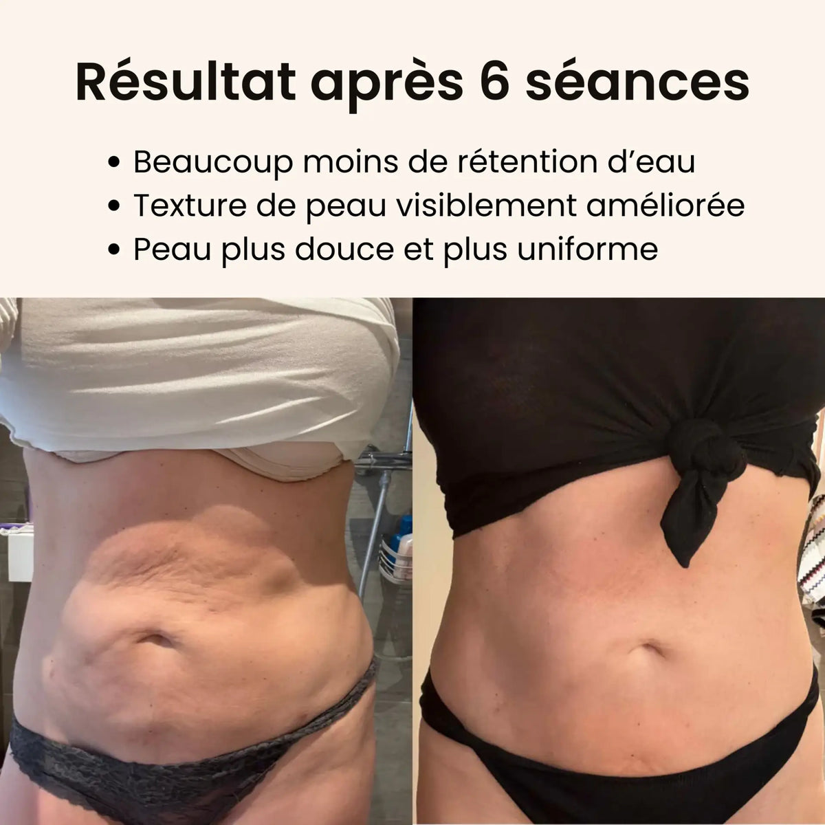 CelluFlow™ - Une peau plus lisse en 14 jours